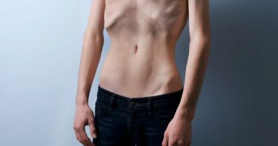 Científicos descubren ‘prometedor’ tratamiento para la anorexia nerviosa