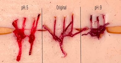 Inventan hilos de sutura que cambian de color al detectar heridas infectadas