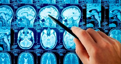 La IA revela variaciones en la anatomía cerebral de personas con autismo