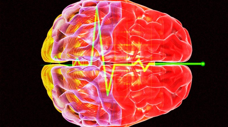 Científicos descubren qué le sucede al cerebro cuando falleces