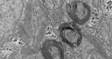 Nuevo 'orgánulo' celular descubierto en el intestino de un tipo de mosca