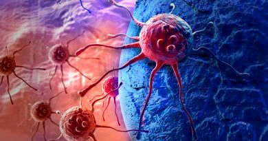 Nueva tecnología permite detectar células cancerígenas mediante análisis de orina