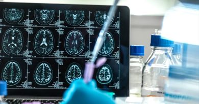 Científicos descubren en Colombia a la segunda persona resistente al alzhéimer
