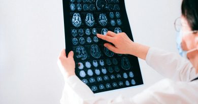 Científicos descubren los marcadores cerebrales del dolor crónico, una 'epidemia silenciosa'