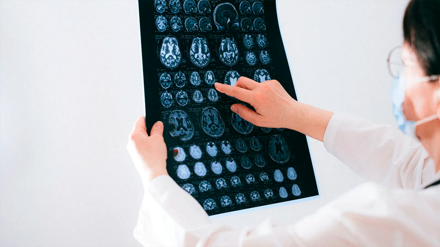 Científicos descubren los marcadores cerebrales del dolor crónico, una 'epidemia silenciosa'