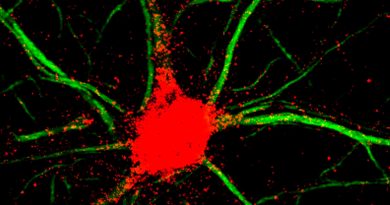 Un nuevo fármaco en investigación aumenta el crecimiento neuronal en células nerviosas
