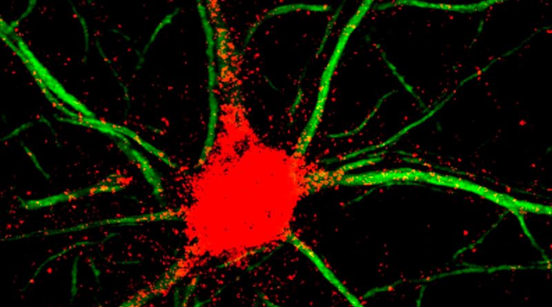 Un nuevo fármaco en investigación aumenta el crecimiento neuronal en células nerviosas