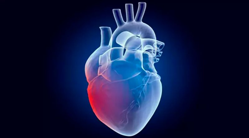 La IA ya supera a los métodos estándar para detectar infartos de miocardio