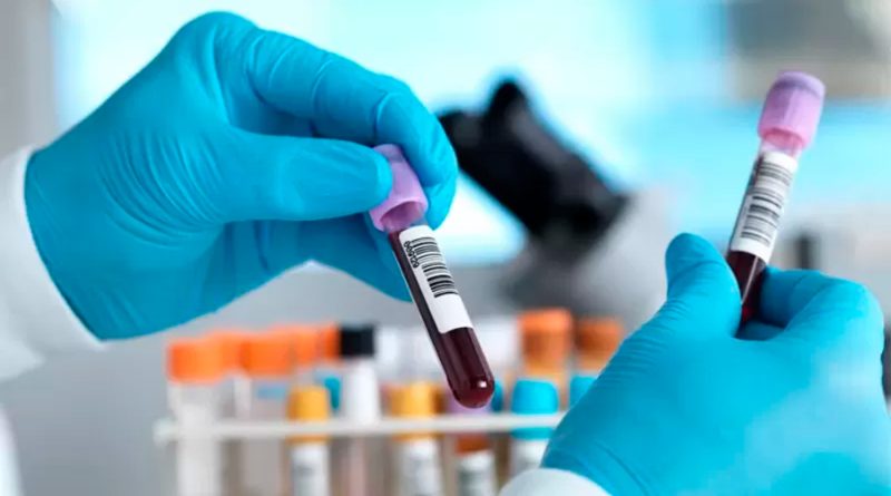 Prometedor examen de sangre que detectar más de 50 tipos cáncer tiene entusiasmados a los científicos