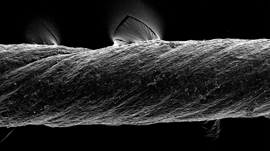 El MIT desarrolla suturas ‘inteligentes’ que liberan fármacos además de unir el tejido