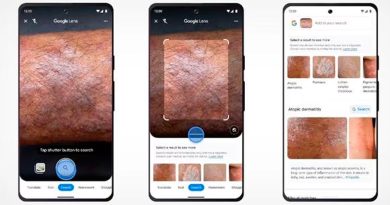 Cómo usar Google Lens para identificar mancha en la piel, desde lunares hasta afecciones graves