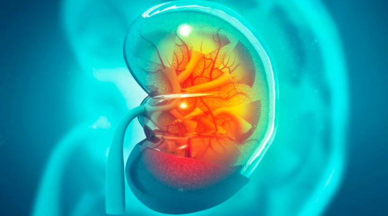 Un estudio descubre por qué un tipo de cáncer de riñón se vuelve metastásico