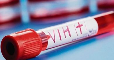Un compuesto presente en el semen restringe la transmisión de una variante del VIH