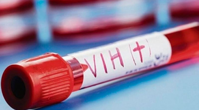Un compuesto presente en el semen restringe la transmisión de una variante del VIH