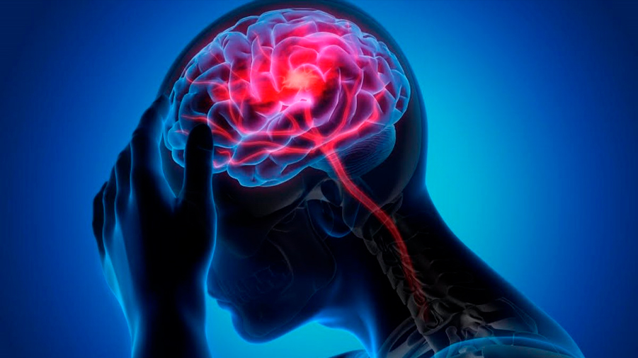 Descubierto un nuevo circuito cerebral para la epilepsia
