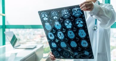Un tumor cerebral poco frecuente responde a un tratamiento dirigido con un éxito 'sin precedentes'
