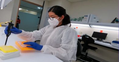 UNAM busca mexicanos a ser parte de JAGUAR, un proyecto que estudia el Lupus