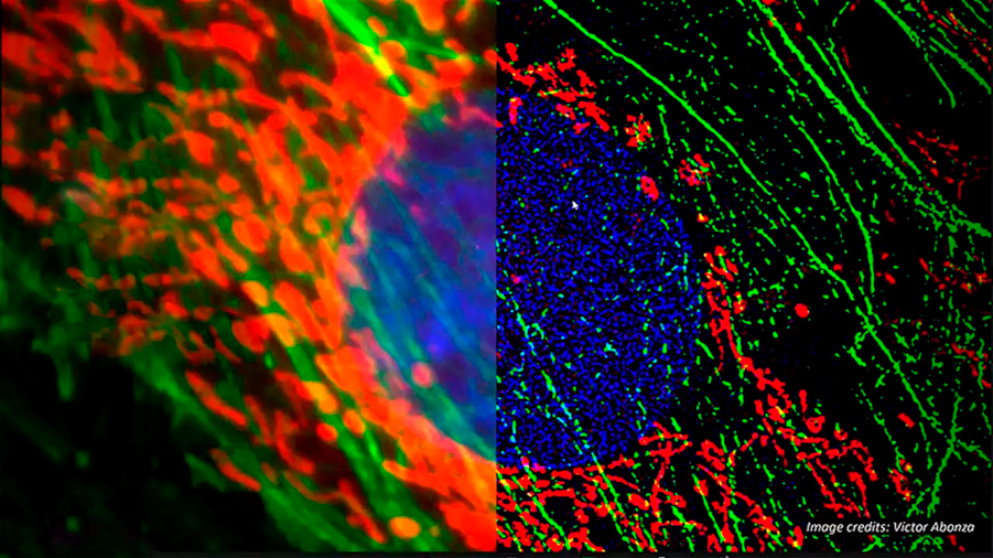 Crean en la UNAM algoritmo que mejora imágenes fluorescentes con superresolución