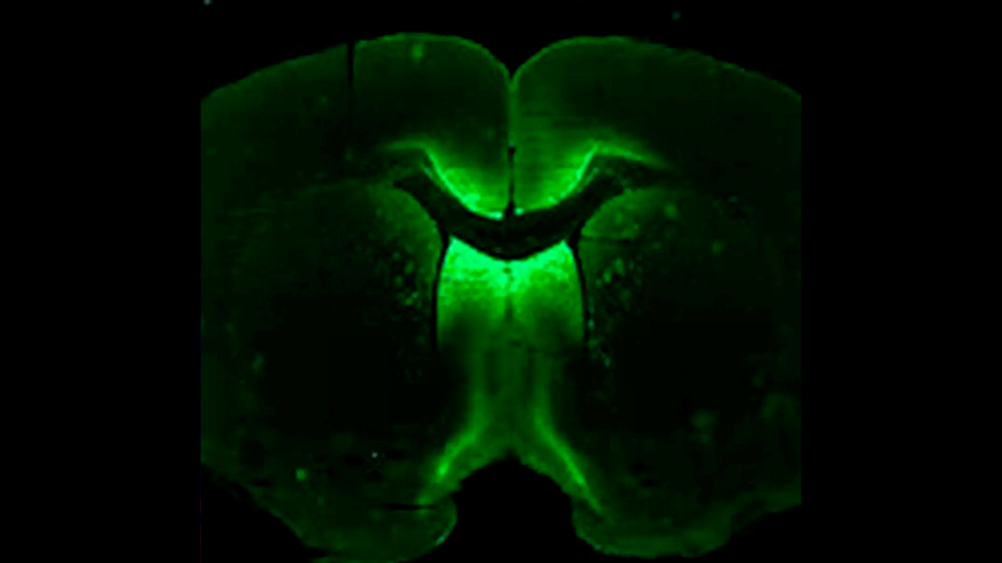 Crearán en la EEI un modelo de cerebro humano autoensamblado para probar medicamentos