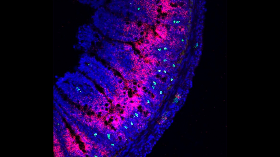 Un estudio muestra cómo se activan las células inmunitarias en el intestino, dependiendo del microbioma