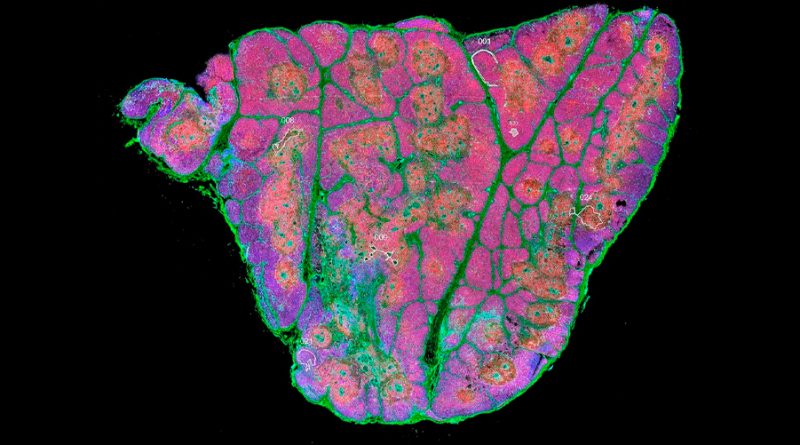 Identifican por primera vez células madre en el timo