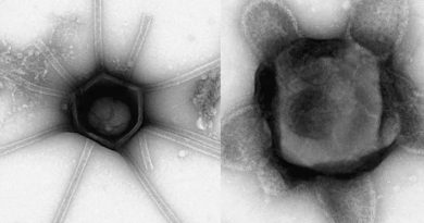 Científicos descubren virus gigantes con formas nunca antes vistas