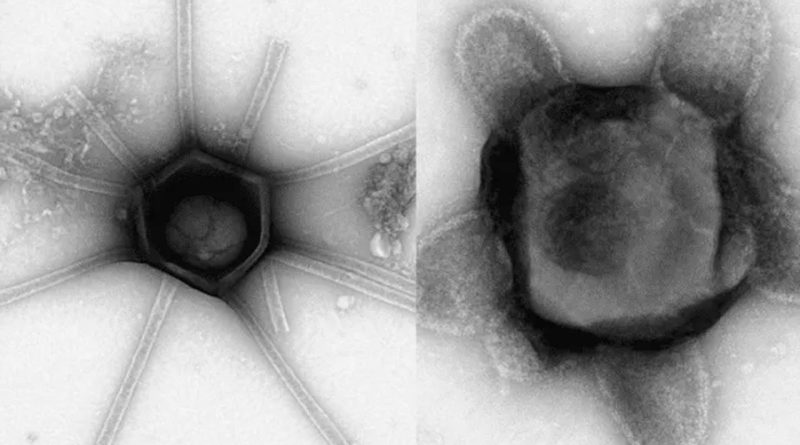 Científicos descubren virus gigantes con formas nunca antes vistas
