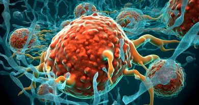 Un hallazgo revela un 'asesino' inesperado de células inmunitarias que carecen de marcador propio