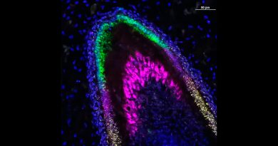 Crean organoides derivados de células madre que secretan proteínas del esmalte dental