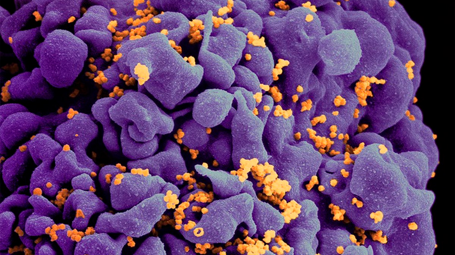 El microbioma intestinal puede aumentar el riesgo y la gravedad del VIH y el Epstein-Barr