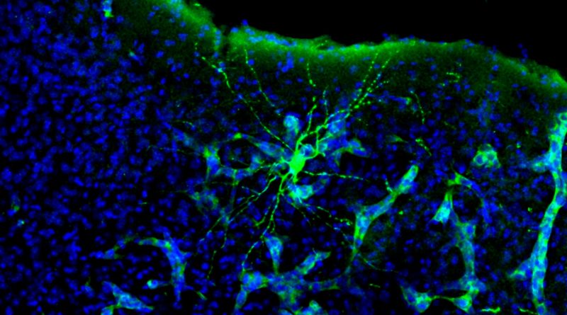 Investigadores españoles descubren cómo los tumores cerebrales 'hackean' la comunicación entre neuronas