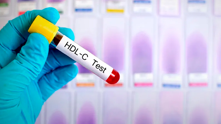 Descubren una manera de revertir la infertilidad al reducir el colesterol HDL