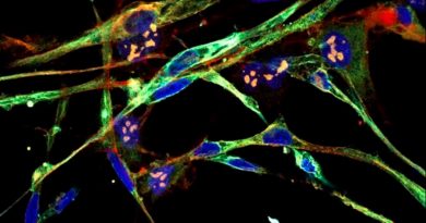 Los científicos logran transformar células de cáncer agresivas en células sanas