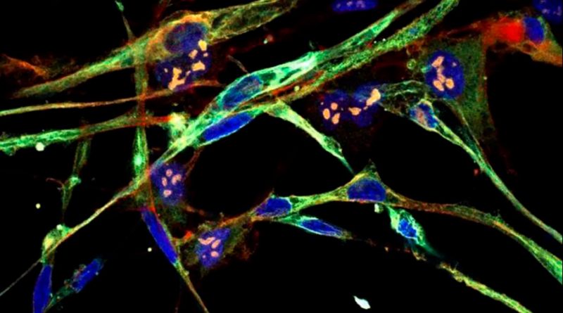 Los científicos logran transformar células de cáncer agresivas en células sanas