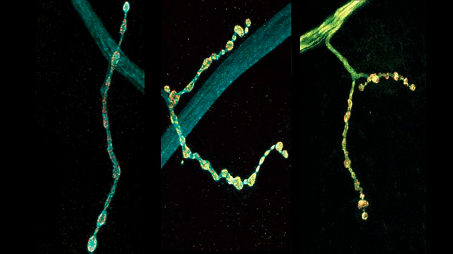 Las neuronas individuales mezclan múltiples ediciones de ARN de la proteína sinapsis clave: estudio en mosca