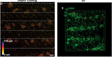 Logran 'bioimpresión' de redes de células cerebrales vivas en el laboratorio