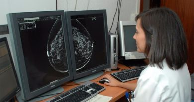 Descubren una vulnerabilidad en el cáncer de mama triple negativo a la inmunoterapia