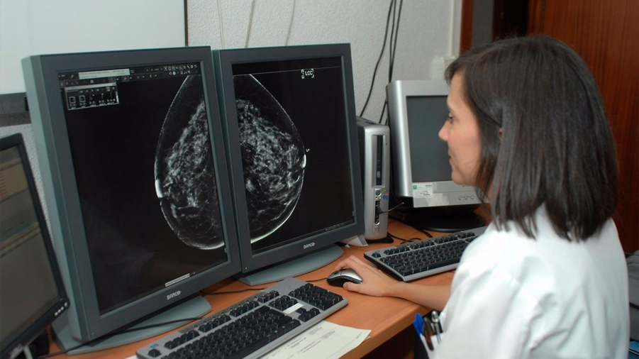 Descubren una vulnerabilidad en el cáncer de mama triple negativo a la inmunoterapia