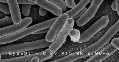 Diferentes cepas de E. coli pueden competir entre sí para apoderarse del intestino