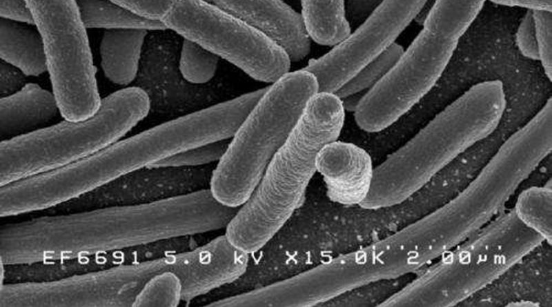 Diferentes cepas de E. coli pueden competir entre sí para apoderarse del intestino