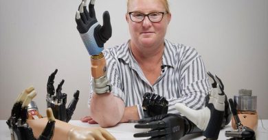 Una revolucionaria mano biónica se fusiona directamente con el cuerpo humano