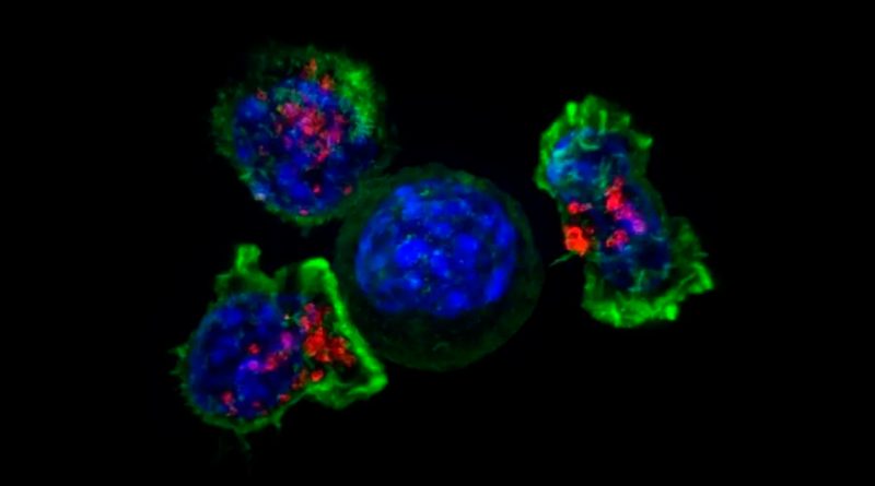 Esta debilidad en las células del cáncer del páncreas permite eliminar el tumor