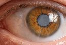 La ciencia detrás de la aparición de cataratas en los ojos