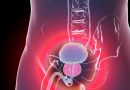 Un fármaco prolonga la supervivencia en el cáncer de próstata con mutaciones genéticas