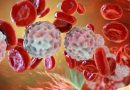 Reemplazar sangre enferma por sangre sana: la nueva alternativa contra leucemia