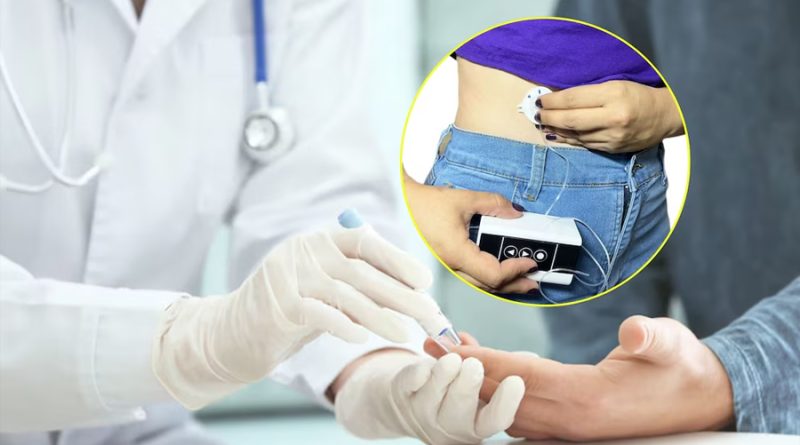 Crean páncreas artificial para pacientes con diabetes: así funciona el innovador dispositivo desarrollado por colombianos