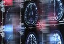 La ciencia descubre una nueva alerta temprana del Alzheimer en la visión