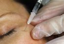 La locura del DIY llegó a tu rostro: ¿Gente pidiéndole a ChatGPT cómo inyectarse bótox en casa? Sí, y es tan mala idea como suena