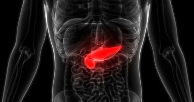 La firma genética es un sistema de alerta temprana para el cáncer de páncreas agresivo