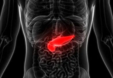 La firma genética es un sistema de alerta temprana para el cáncer de páncreas agresivo
